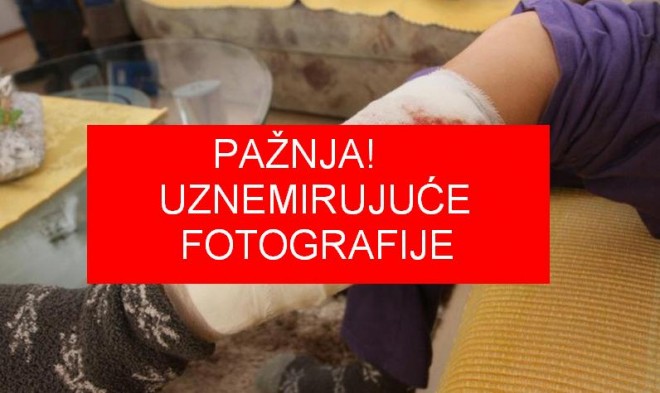 uznemirujući sadržaj