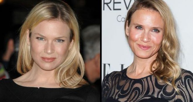 Šta se dogodilo s licem Renee Zellweger?!