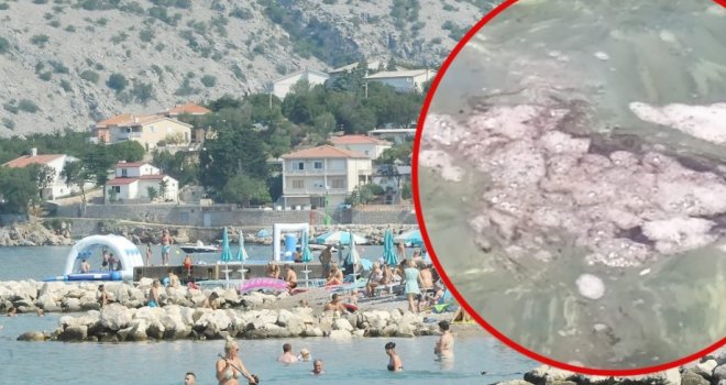 Opasna bakterija raširila se po plaži kod Novog Vinodolskog: Zašto su djeca masovno dobila proljev i povraćaju?!